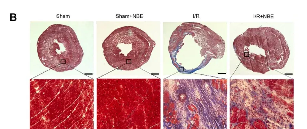 Four Masson's trichrome heart cross-sections three months after surgery in aged mice, showing progressively less blue fibrotic scarring in the plasma-exchange-treated hearts.